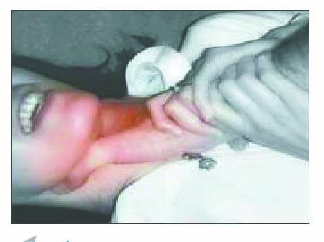 Strangled wife killed